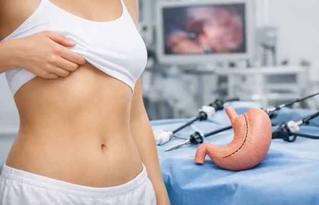 Guide to Scarless Gastric Sleeve Surgery