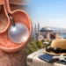 Guide to Gastric Balloon in Turkey for Travellers