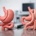 OAGB versus Roux-en-Y Bypass: Key Differences