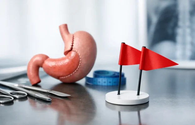Bariatric Surgery Red Flags You Should Not Ignore
